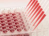 Verlässliche Antikörpertests für die COVID-19 Diagnostik - die beiden Biotechnologieunternehmen CANDOR Bioscience GmbH und trenzyme GmbH leisten mit ihren Produkten einen wichtigen Beitrag für die COVID-19 Test-Entwicklung
