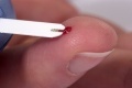 Diabetes und kein Ende in Sicht