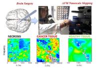 Untersuchungen zur Biomechanik der Zelle mit JPKs NanoWizard®- und CellHesion®-Rasterkraftmikroskopen an der Katholischen Universität Rom