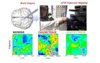The Catholic University of Rome uses the JPK NanoWizard® AFM & CellHesion® systems to understand how cells sense and respond to mechanical stimuli