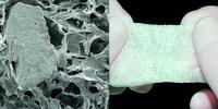 Jetzt bei m&k: Matri(TM) BONE MAX zur Knochenaugmentation und -rekonstruktion