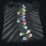 ECR 2020: New imaging solutions for enhanced clarity and cost-efficiency