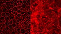 DNA transponierbarer Elemente als Ursache für altersbedingte Makuladegeneration (AMD) identifiziert