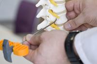 Osteoporose: Eine teure Volkskrankheit