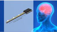 Brain Implant Gives New Hope to Epileptics