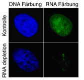 RNA-Moleküle packen aus