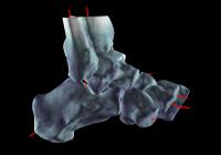 Perspektive DVT – Präoperative Planung und postoperative Kontrolle mit dem SCS DVT