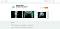 mediCAD Web - available as integrated partner application in teamplay from Siemens Healthineers