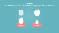 Zahn-Veneers: Wann sind sie sinnvoll?
