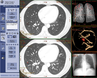 Centricity® RIS/PACS – schnelle Anwendungen und tiefgreifende klinische Tools
