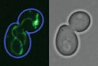 Das Protein OXA spielt eine wichtige Rolle beim Einbau von Eiweißmolekülen in Mitochondrien