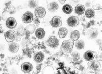 Schwarze Schafe unter guten Bekannten: Warum Epstein-Barr-Virus-Infektionen manchmal Krebs auslösen