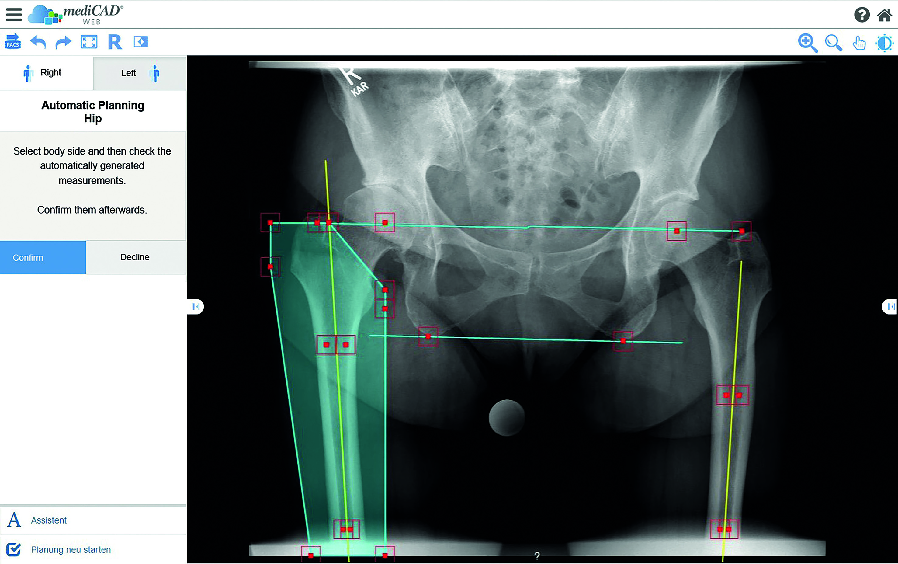 Medicad Web Available As Integrated Partner Application In Teamplay From Siemens Healthineers 6781