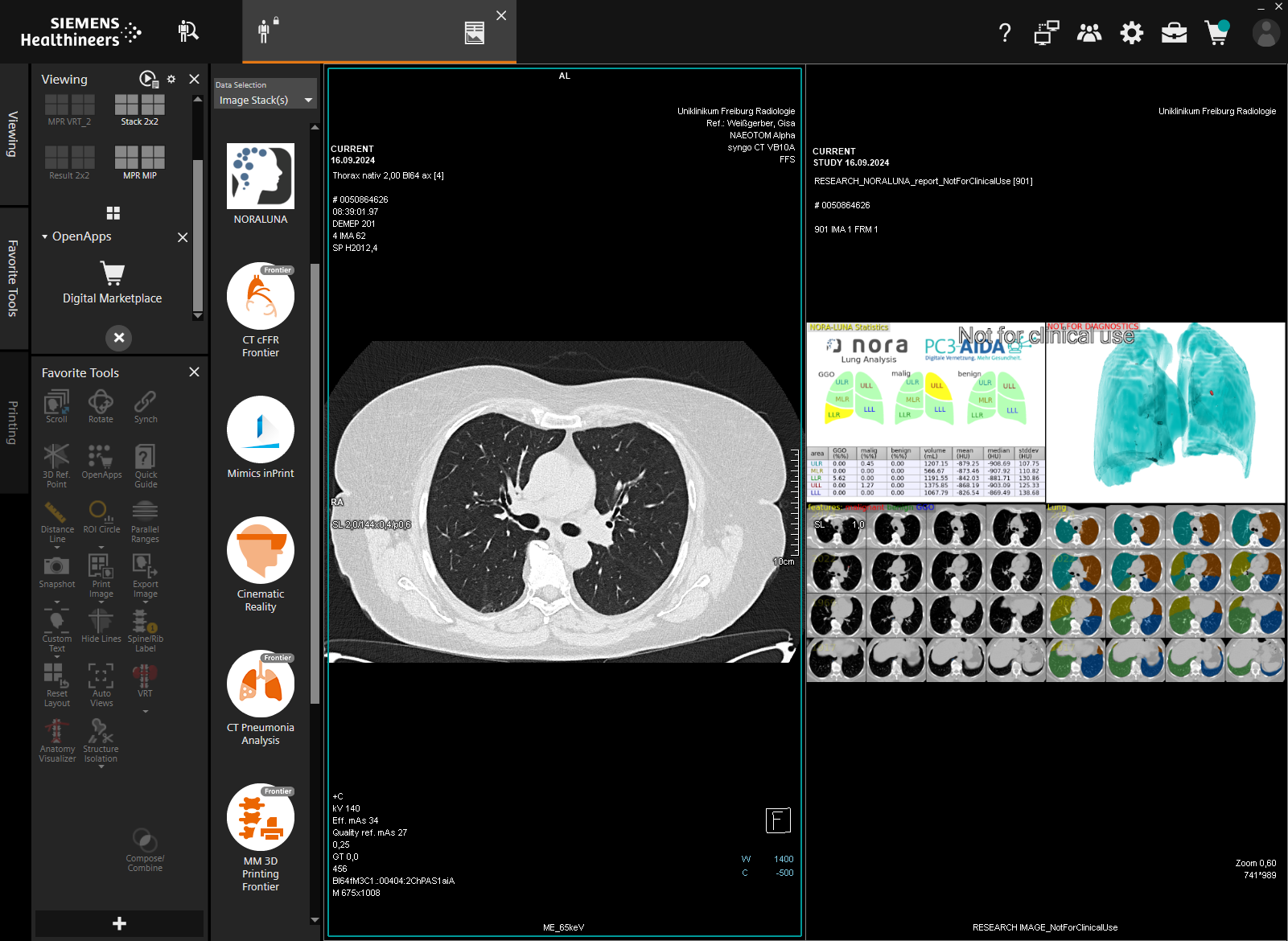 Digital vernetzt für bessere Diagnostik: PC3-AIDA bringt modernste ...