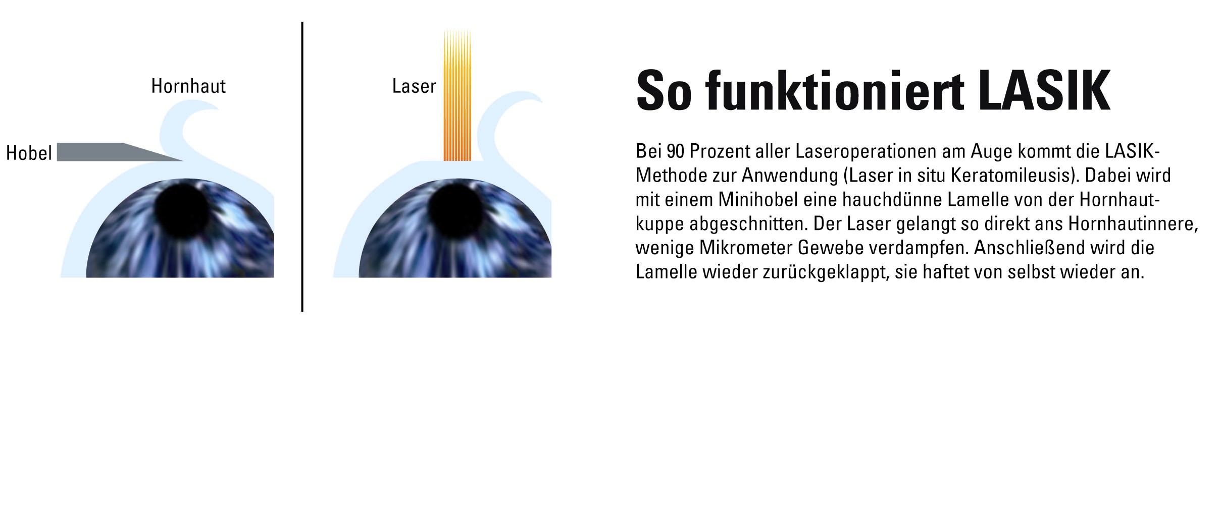 Der Lasik Tuv Sorgt Fur Durchblick Bei Laseroperationen Am Auge Tuv Sud Ag Pressemitteilung Pressebox