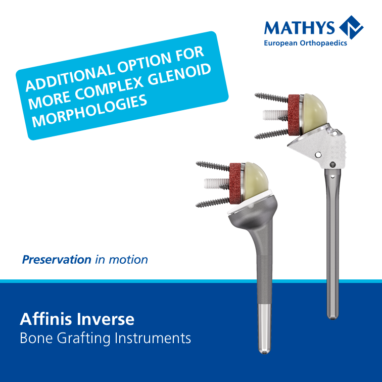 Efficient, smart and fully guided: Mathys presents the new Affinis ...