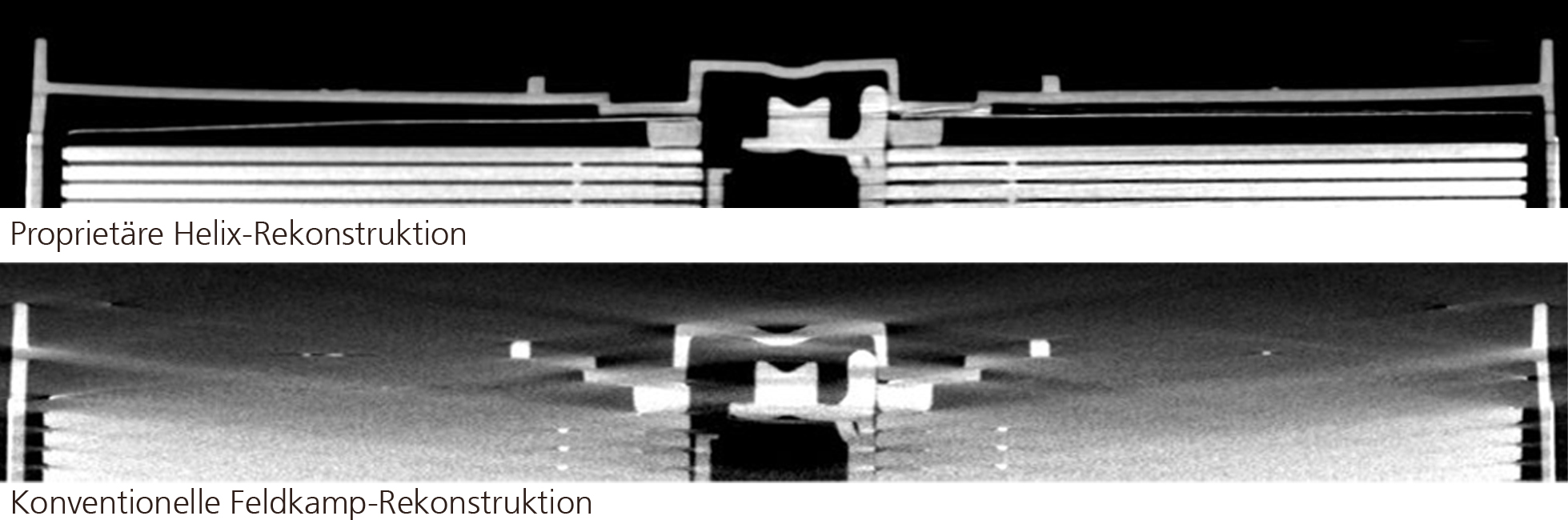 Die Neue Helix-CT Des Fraunhofer IIS: Aus Für Feldkamp-Artefakte ...