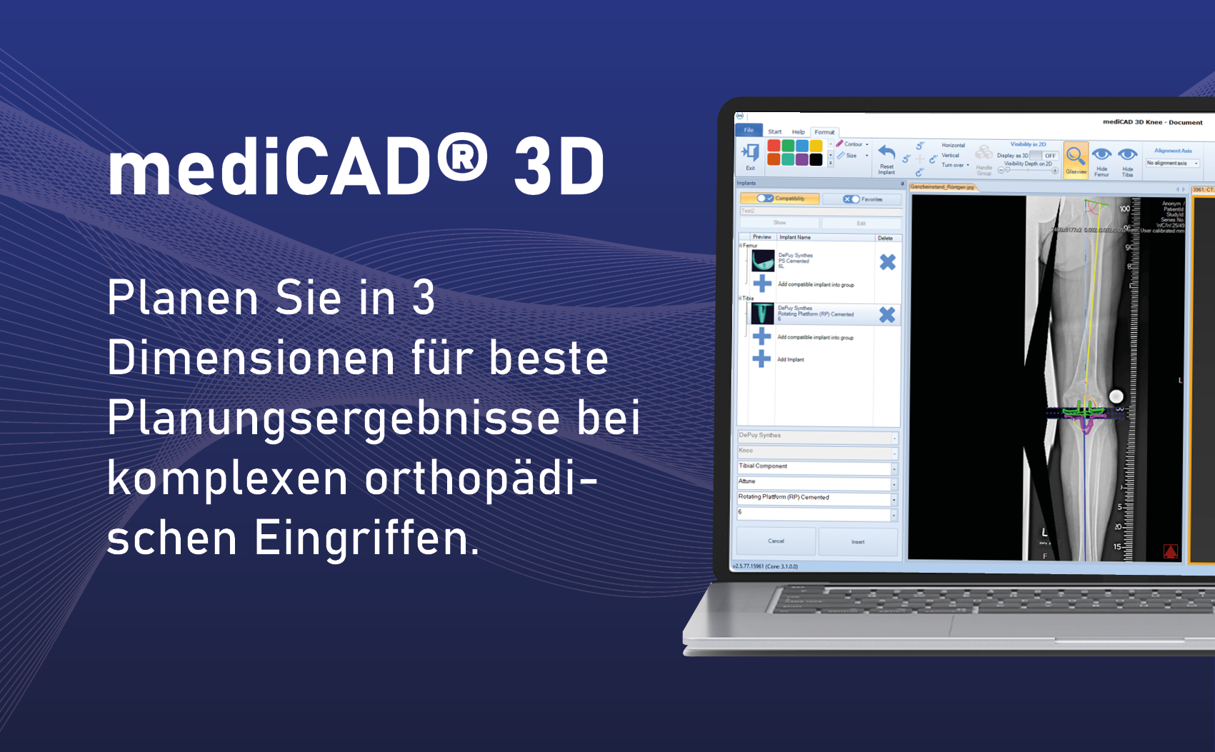 mediCAD® 3D, mediCAD Hectec GmbH, Story - PresseBox