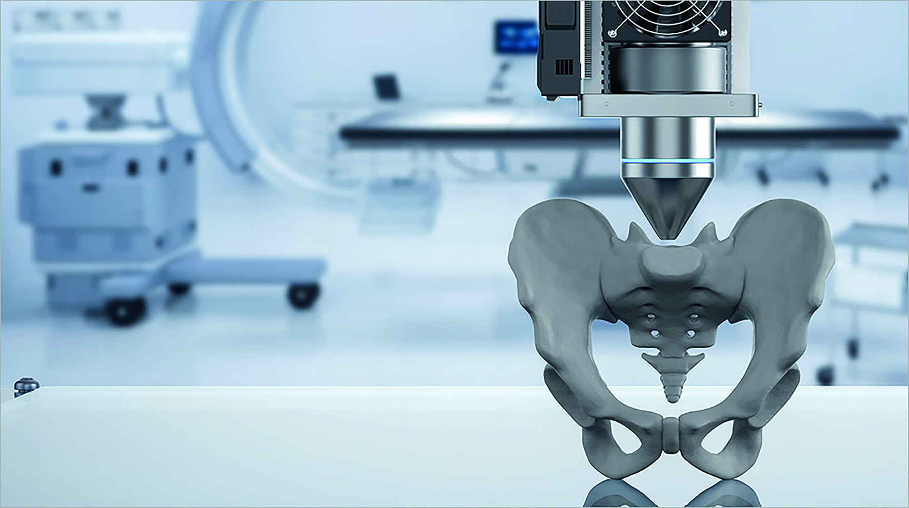 3D Druck in der präoperativen orthopädischen Planungsphase, mediCAD