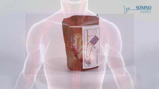 ABPMpro von SOMNOmedics – oszillometrische Langzeit-Blutdruckmessung
