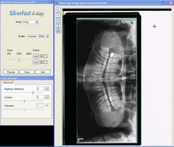 x-ray1.jpg
