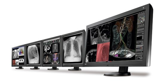 EIZO RadiForce DRK 2013.jpg