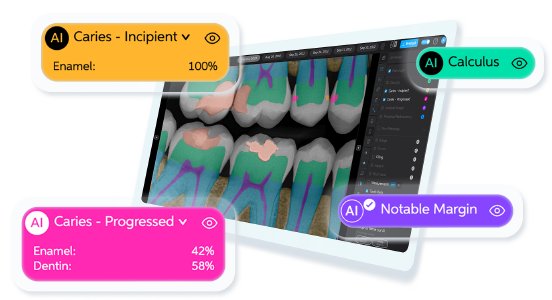 Pearl and Dentsply.png