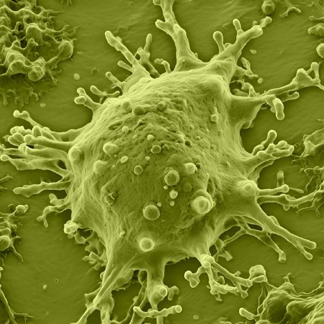 Mycoplasma_AI_1_green.png