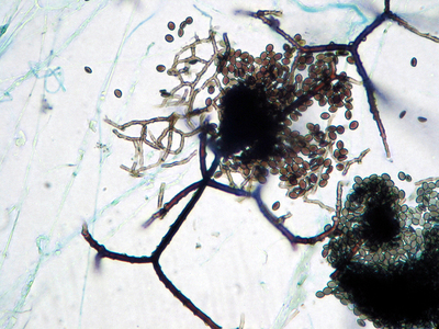 abb_03chaetomium.jpg