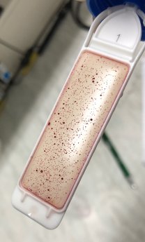 Produktionshygiene_für_ETL-_Anlagen_DipSlide_Bakt_01.JPG