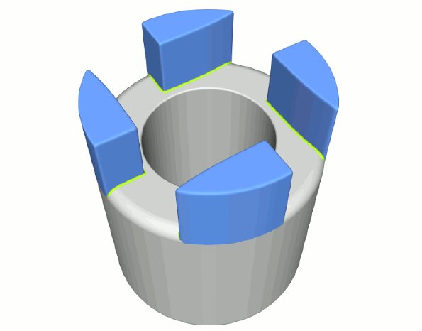 5-Ventricular-Assist-Device-Variation.gif