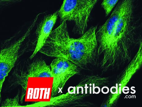 2025_05_07 Kooperation-CR-Antibodiescom_MitZitaten_LHa_Freigabe-11-07-2025_sei.jpg