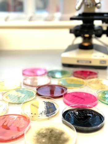 SMS Labs adds Listeria monocytogenes challenge testing to its portfolio.png