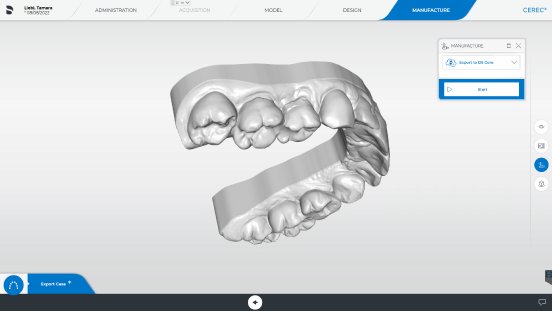 CER-press-release-image-CEREC-SW-5.3-Upload-Function.png