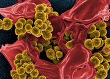 pm-boten-rna-staphylococcus-aureus.jpg