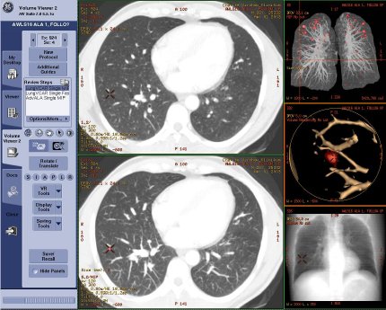 GE Healthcare Lungen VCAR.jpg
