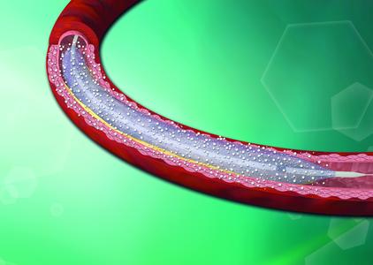 Das Produkt LEGFLOW der CARDIONOVUM GmbH