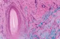 Magnification of a false-color Masson’s Trichrome image of a cm-scale tissue sample measured with two-photon imaging. Pink is a fluorescent protein stain, Purple is a DNA stain, and blue is SHG in Collagen connective tissue.
