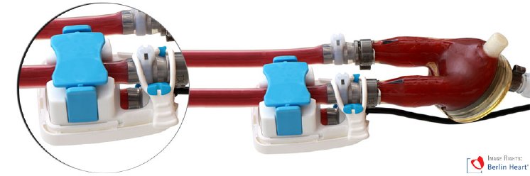 Customized SONOFLOW clamp-on ultrasonic sensor on EXCOR®_2.jpg