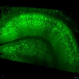 pi_0139-2014_mouse-hippocampus.jpg