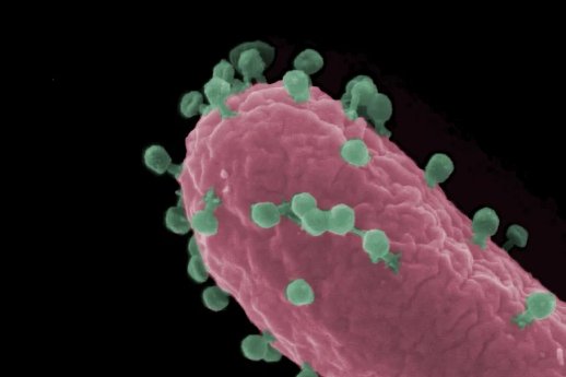 csm_Escherichia_coli_phage_20ce7ffb5f.webp