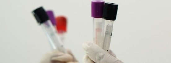laboratory-5601435_1280-583x215.jpg