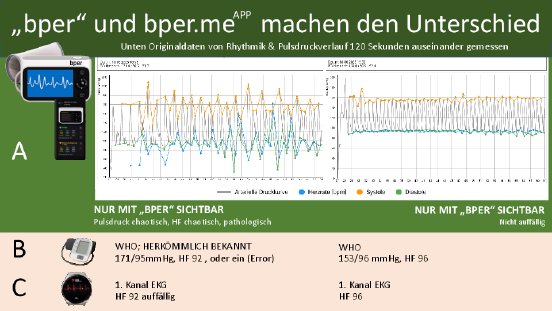 Pulsdruck sehr stark auffällig HF chaotisch pathologisch 19 08 2025.pdf