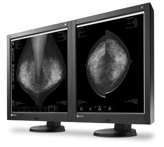 EIZO RadiForce GX540
