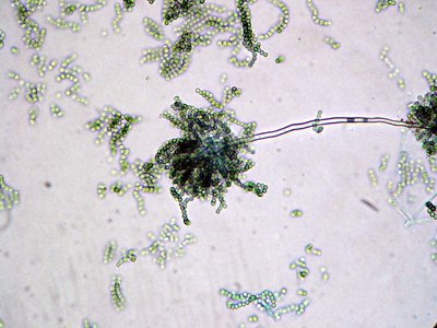 abb_04aspergillus.jpg
