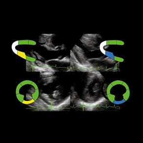 TOMTEC STRESS ECHO