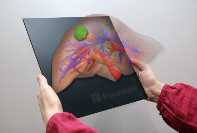 Medizin_Die Leber in 3D und Farbe_Fraunhofer IGD.jpg