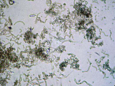 abb_05penicillium.jpg