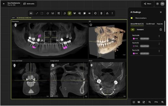 CORP-press-release-image-Smart-View-Detect-3.png