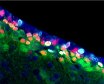 12.11.19._Gen-Schalter für Neubildung von Nervenzellen im Zebrafisch.jpg